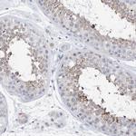 PLK4 Antibody in Immunohistochemistry (Paraffin) (IHC (P))