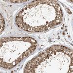 ABCB9 Antibody in Immunohistochemistry (Paraffin) (IHC (P))