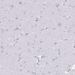 IKAROS Antibody in Immunohistochemistry (Paraffin) (IHC (P))