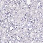 IKAROS Antibody in Immunohistochemistry (Paraffin) (IHC (P))