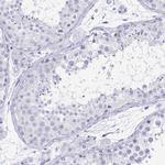 IKAROS Antibody in Immunohistochemistry (Paraffin) (IHC (P))