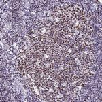 IKAROS Antibody in Immunohistochemistry (Paraffin) (IHC (P))