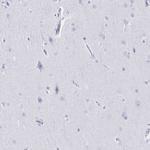 IKAROS Antibody in Immunohistochemistry (Paraffin) (IHC (P))