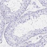 IKAROS Antibody in Immunohistochemistry (Paraffin) (IHC (P))