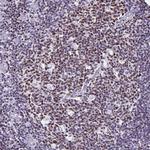 IKAROS Antibody in Immunohistochemistry (Paraffin) (IHC (P))