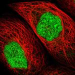 UPP2 Antibody in Immunocytochemistry (ICC/IF)