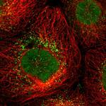 UPP2 Antibody in Immunocytochemistry (ICC/IF)