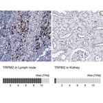 TRPM2 Antibody in Immunohistochemistry (Paraffin) (IHC (P))