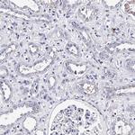 TRPM2 Antibody in Immunohistochemistry (Paraffin) (IHC (P))