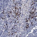 TRPM2 Antibody in Immunohistochemistry (Paraffin) (IHC (P))