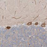 FGF19 Antibody in Immunohistochemistry (Paraffin) (IHC (P))