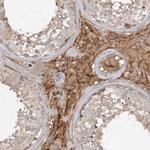 FGF19 Antibody in Immunohistochemistry (Paraffin) (IHC (P))