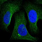 Tankyrase 2 Antibody in Immunocytochemistry (ICC/IF)