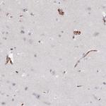 CD34 Antibody in Immunohistochemistry (Paraffin) (IHC (P))