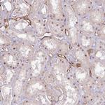 CD34 Antibody in Immunohistochemistry (Paraffin) (IHC (P))