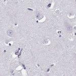 CRX Antibody in Immunohistochemistry (Paraffin) (IHC (P))