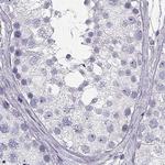 CRX Antibody in Immunohistochemistry (Paraffin) (IHC (P))