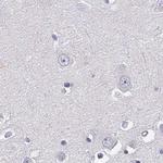 CRX Antibody in Immunohistochemistry (Paraffin) (IHC (P))