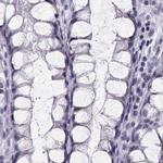 CRX Antibody in Immunohistochemistry (Paraffin) (IHC (P))