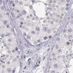 CRX Antibody in Immunohistochemistry (Paraffin) (IHC (P))