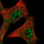 IL-15 Antibody in Immunocytochemistry (ICC/IF)