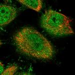 Shootin1 Antibody in Immunocytochemistry (ICC/IF)