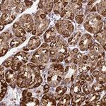 DRAK1 Antibody in Immunohistochemistry (Paraffin) (IHC (P))