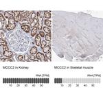 MCCC2 Antibody in Immunohistochemistry (Paraffin) (IHC (P))