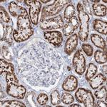 MCCC2 Antibody in Immunohistochemistry (Paraffin) (IHC (P))