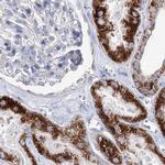 MCCC2 Antibody in Immunohistochemistry (Paraffin) (IHC (P))