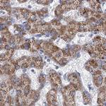 MCCC2 Antibody in Immunohistochemistry (Paraffin) (IHC (P))