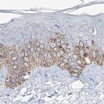 MCCC2 Antibody in Immunohistochemistry (Paraffin) (IHC (P))