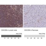 CDC25B Antibody in Immunohistochemistry (Paraffin) (IHC (P))