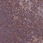 CDC25B Antibody in Immunohistochemistry (Paraffin) (IHC (P))