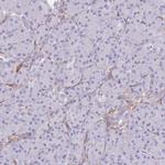 CDC25B Antibody in Immunohistochemistry (Paraffin) (IHC (P))