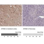 AP3B2 Antibody in Immunohistochemistry (Paraffin) (IHC (P))