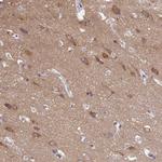 AP3B2 Antibody in Immunohistochemistry (Paraffin) (IHC (P))