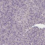 AP3B2 Antibody in Immunohistochemistry (Paraffin) (IHC (P))