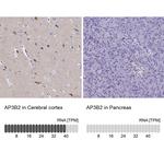 AP3B2 Antibody in Immunohistochemistry (Paraffin) (IHC (P))