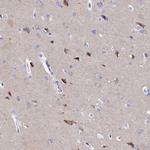 AP3B2 Antibody in Immunohistochemistry (Paraffin) (IHC (P))