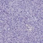 AP3B2 Antibody in Immunohistochemistry (Paraffin) (IHC (P))