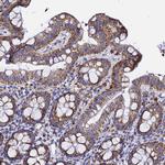 REA Antibody in Immunohistochemistry (Paraffin) (IHC (P))