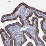 REA Antibody in Immunohistochemistry (Paraffin) (IHC (P))