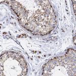 REA Antibody in Immunohistochemistry (Paraffin) (IHC (P))