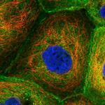 Coronin 1B Antibody in Immunocytochemistry (ICC/IF)