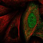 TALDO1 Antibody in Immunocytochemistry (ICC/IF)