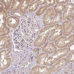 ACVR2B Antibody in Immunohistochemistry (Paraffin) (IHC (P))