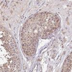 ACVR2B Antibody in Immunohistochemistry (Paraffin) (IHC (P))