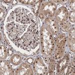 NEK8 Antibody in Immunohistochemistry (Paraffin) (IHC (P))