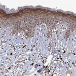 NEK8 Antibody in Immunohistochemistry (Paraffin) (IHC (P))